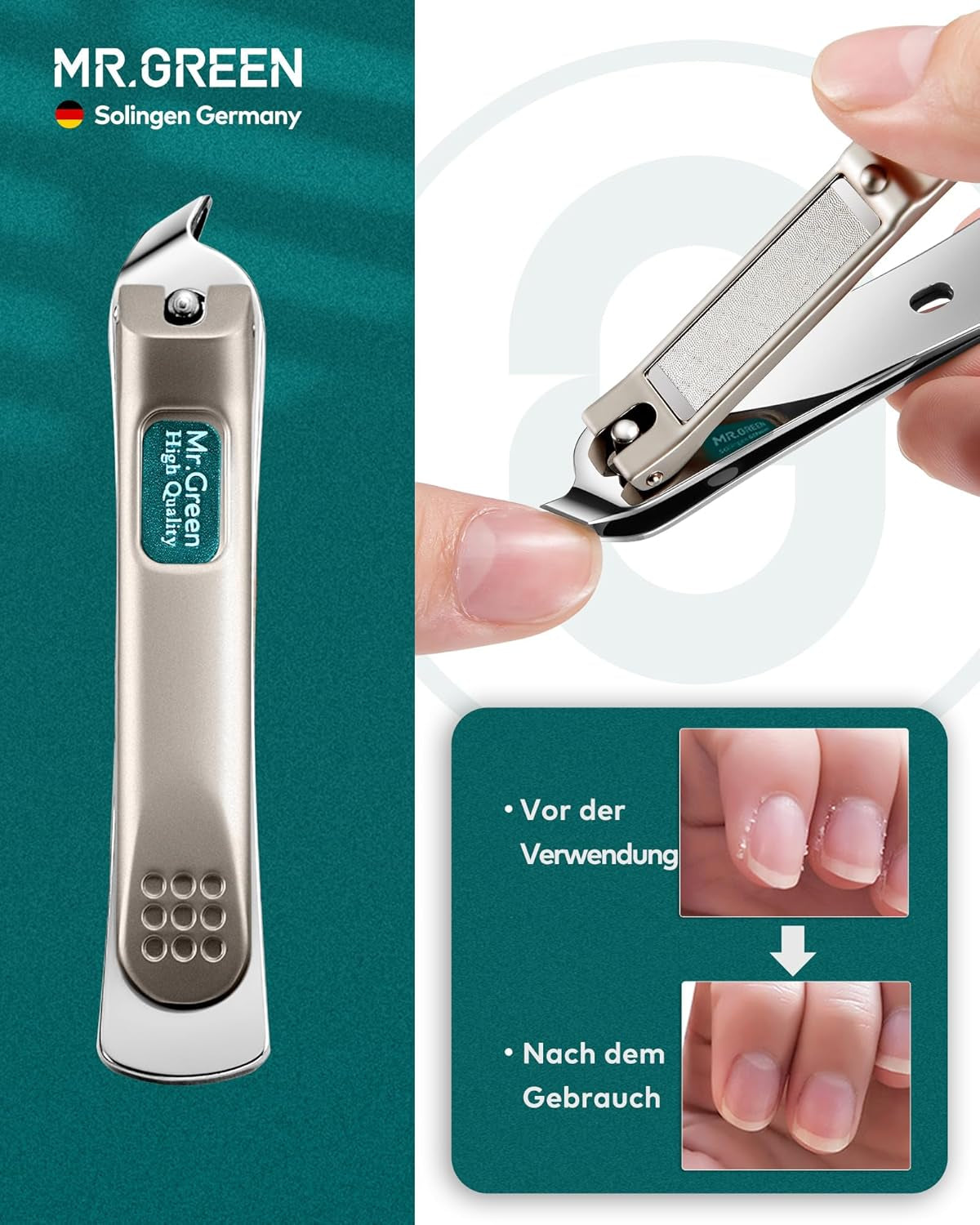 MR.GREEN Nagelknipser, 3 Stück Fingernagel Knipser Set, Solingen Edelstahl Nagelzwicker Maniküre Set, Mit Hochwertigem Lederetui, Hochwertiges Nail Clipper